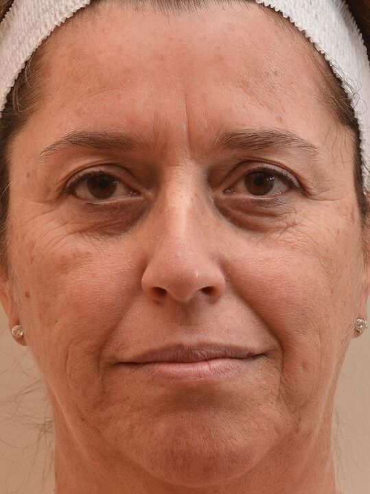 Taigi aš pažiūrėjau prieš naudodamas „Eudalie“ kremą