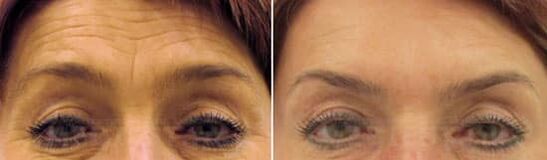 Lauko kaktos atjauninimas