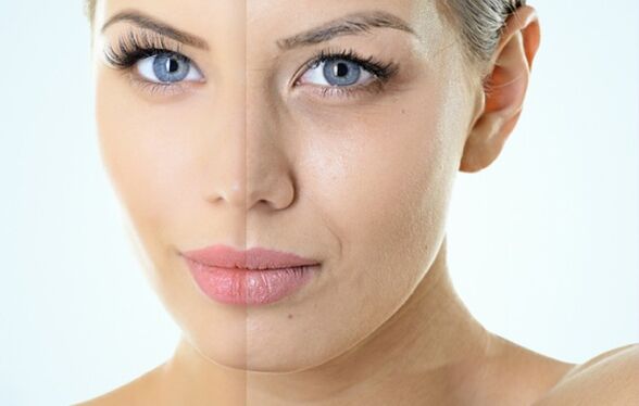 Trupmeninio atjauninimo indikacijos